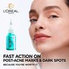 L'Oréal Paris Bright Reveal Peeling For Dark Spots - 25 ml