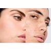 Vichy Normaderm Dermo-Purifying Toner - 200 ml.