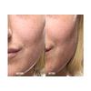 Grown Alchemist Skin Renewal Serum  – 25 ml.