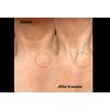The Inkey Bio-Active Ceramide Neck Lift Stick – 20 g.
