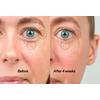 The Inkey Bio-Active Ceramide Eye Cream – 18 ml.